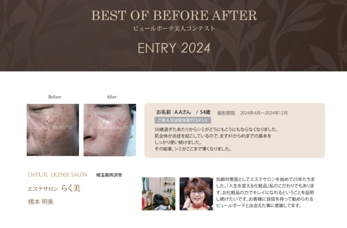 美人コンテスト
