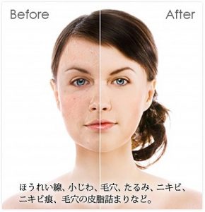 ボーテ｜東洋と西洋、伝統とテクノロジーの融合【らく美】